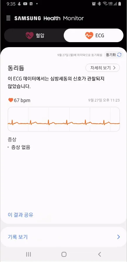 갤럭시 워치 4 심전도 측정 (심방세동)